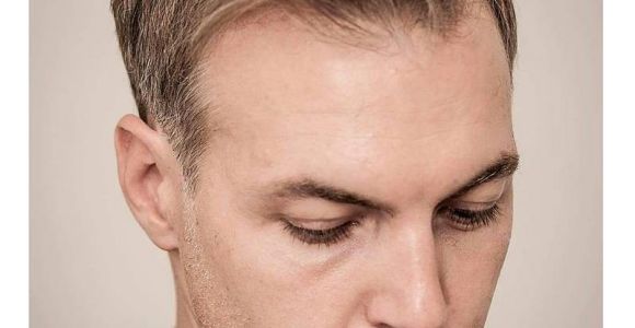 Balding Men S Hairstyles 10 Best Hairstyles for Balding Men