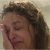 Hairstyles for Thinning Hair Crown Thinning Locks and Bald Patches the Hidden Horrors Of Female Hair
