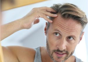 Hairstyles for Unwashed Thin Hair What to Do About Your Thinning Hair Business Insider