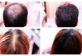 Hairstyles to Cover Up Hair Loss How to Cover Up Hair Loss Bald Spots Thinning Hair Receding