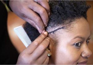 Protective Hairstyles after Braids Thin Hairline You Can Grow It Back with Care and Patience